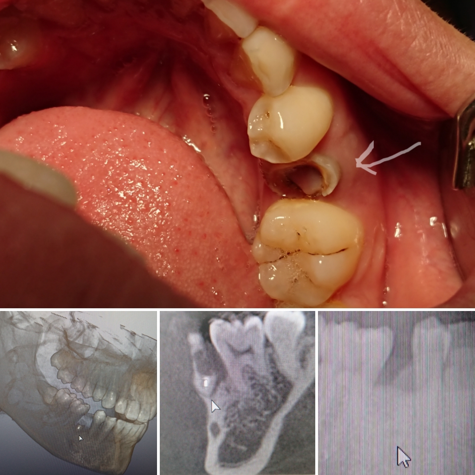 3D-CT