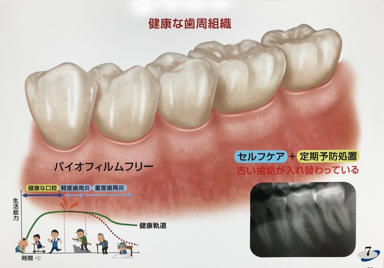 健康な歯茎